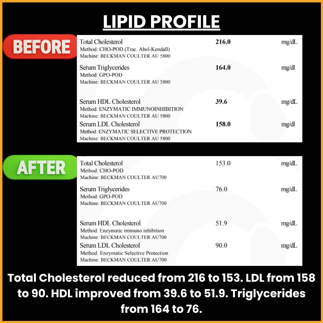 Lipid Profile Transformation
