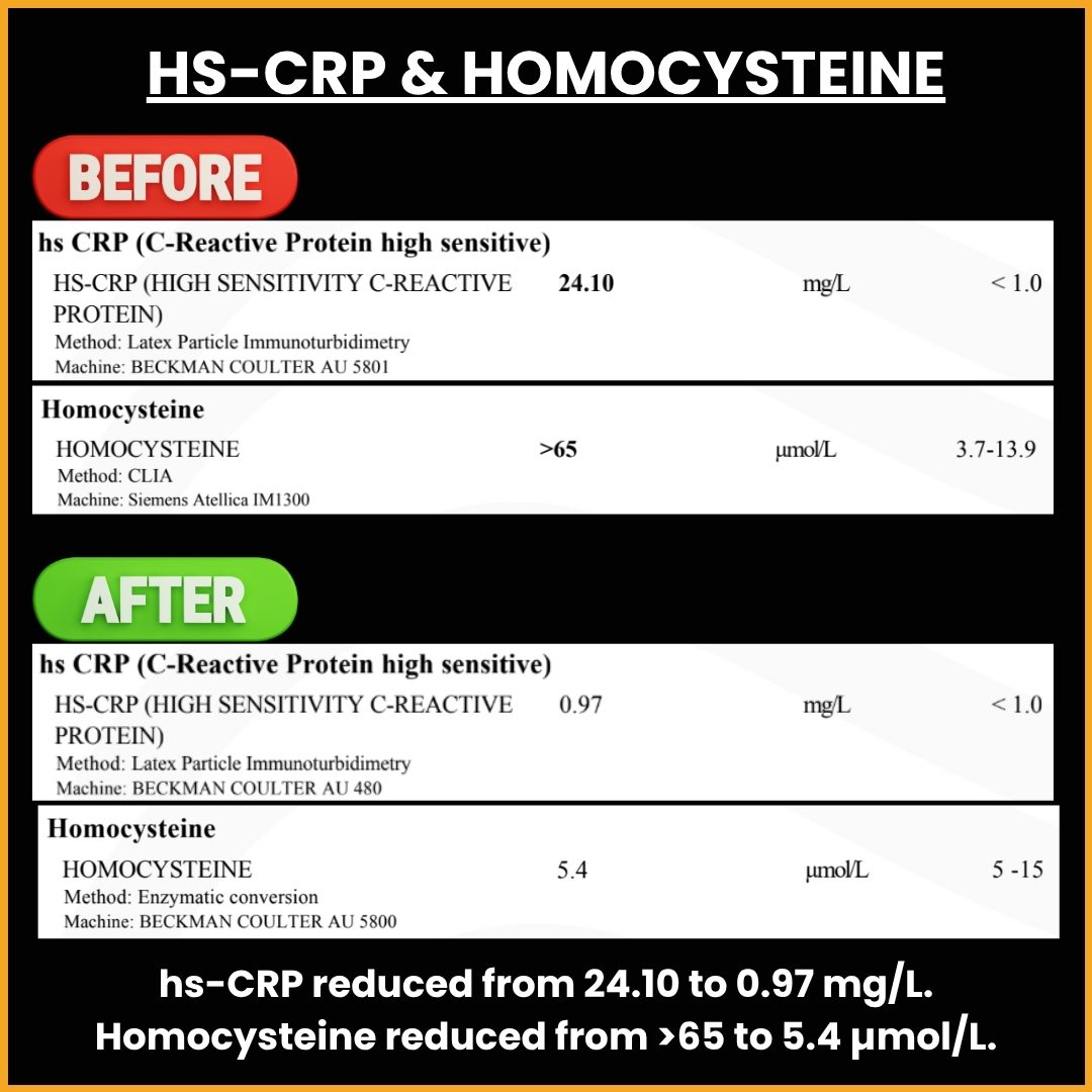 HS-CRP and Homocysteine Transformation