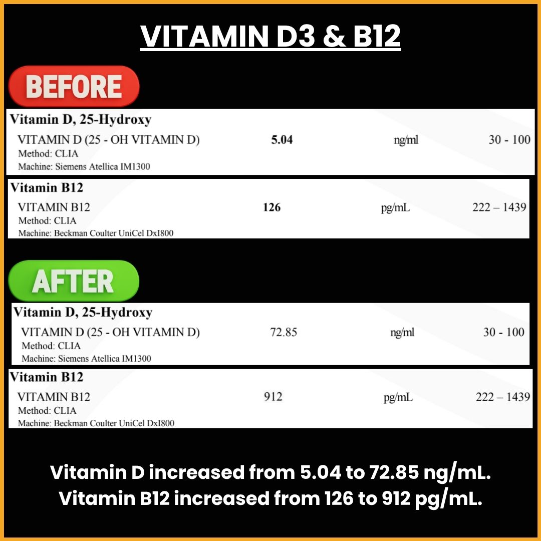 Vitamin D3 and B12 Transformation