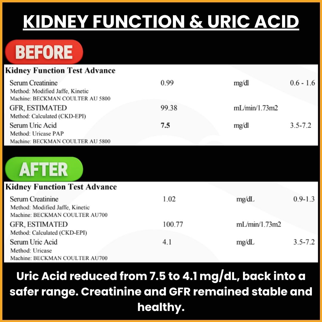 Kidney Function and Uric Acid Transformation